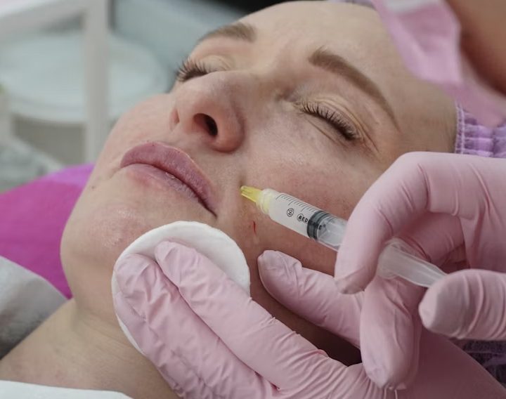 The Anatomy Behind Why Botox Works on Some Lines and Does Nothing to Others