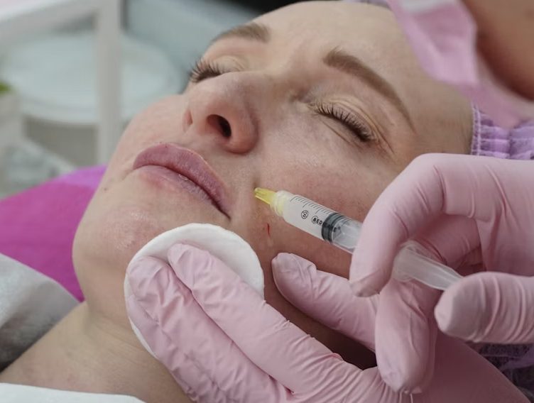 The Anatomy Behind Why Botox Works on Some Lines and Does Nothing to Others