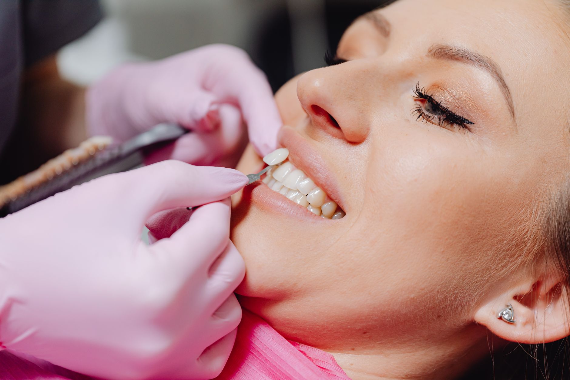 The Ultimate Act of Self-Care: Why Restoring Your Smile Matters
